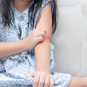 アレルギー外来